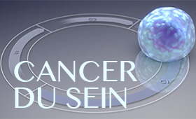 Recherche Cancer du Sein (Corporate)